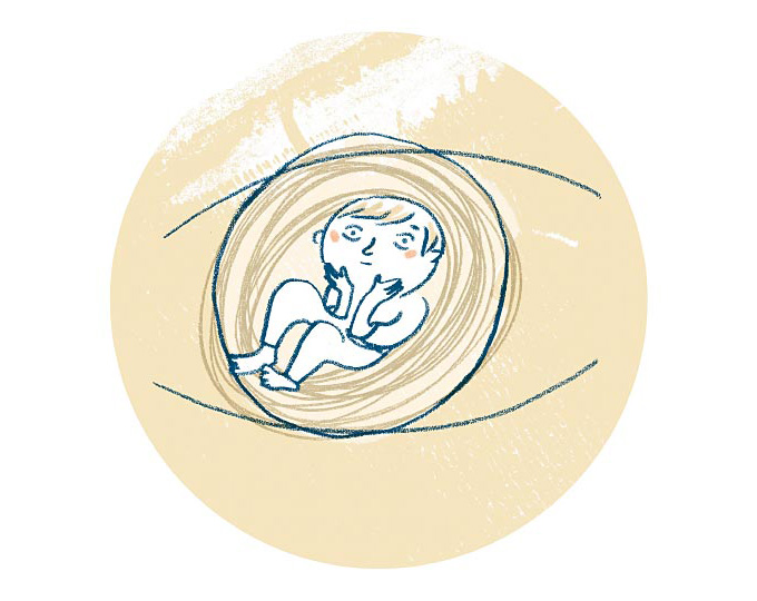 Mit dem Begriff Wachkoma wird umgangssprachlich oft der Zustand einer anhaltenden Bewusstseinsstörung als Folge einer schweren Hirnschädigung bezeichnet.